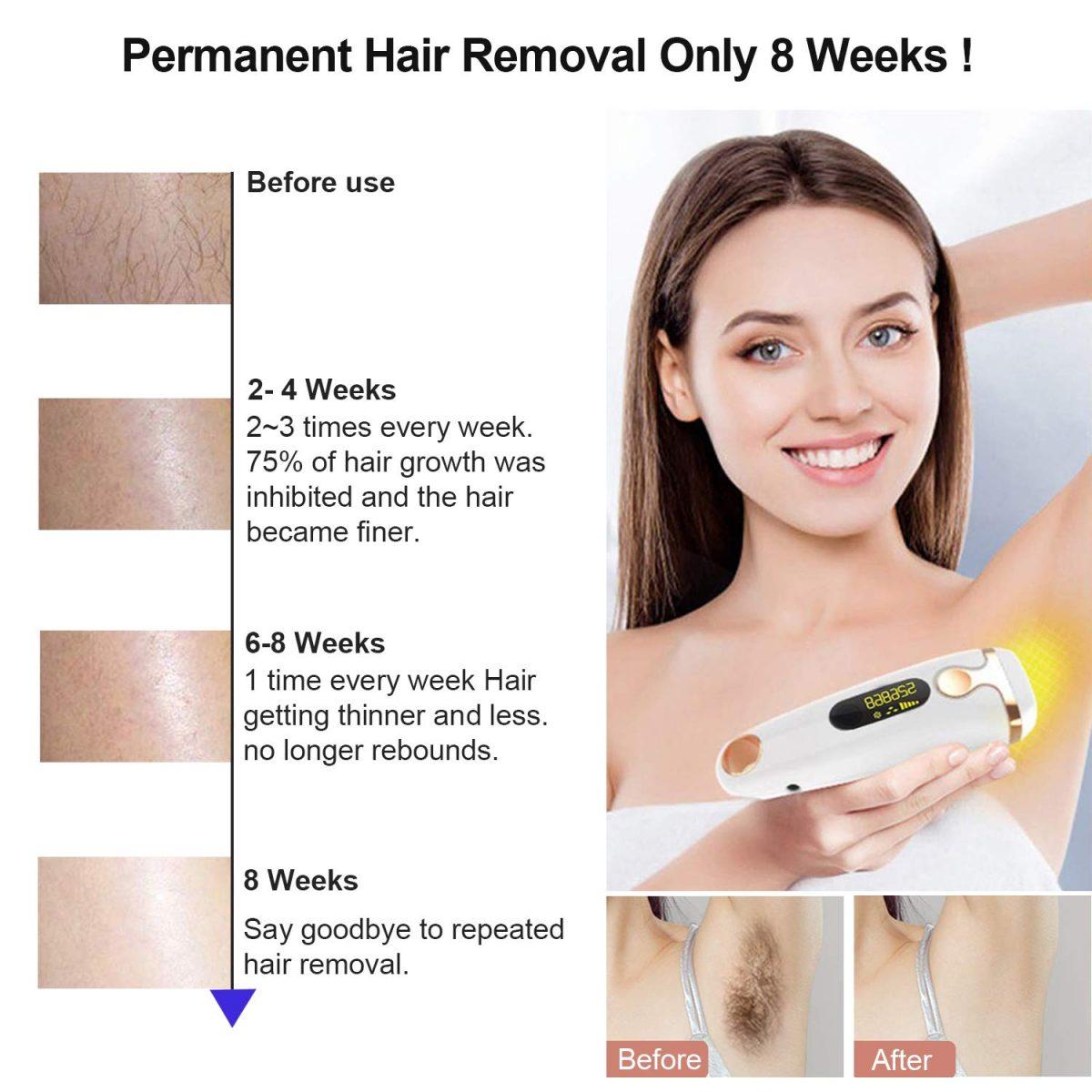 SILK TOUCH PRO IPL HAIR REMOVAL DEVICE 3