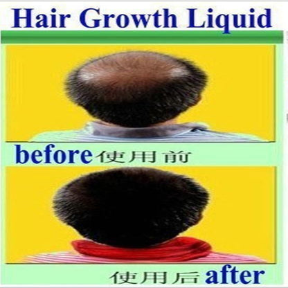 The Organic Hair Growth Essence 3