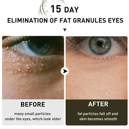 Dinkiss Lutein Eye Essence Oil 3