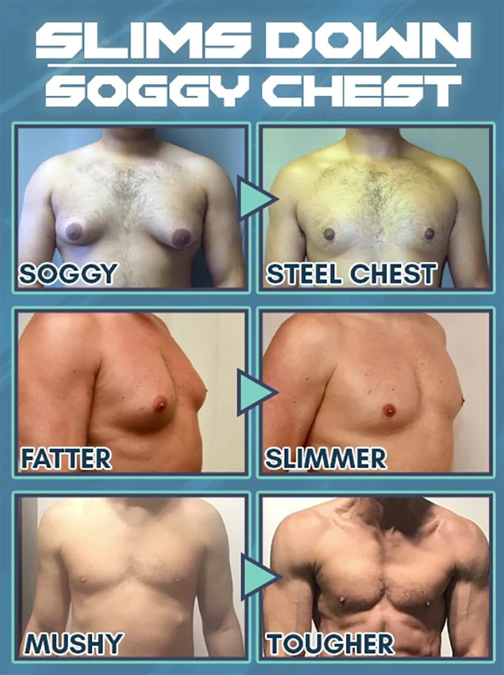 Gynecomastia Reduction Cellulite Spray 3