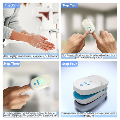 Antifungal Laser Device 3