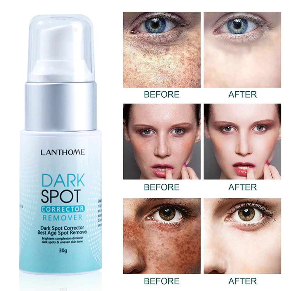 Dark Spot Corrector Remover 3