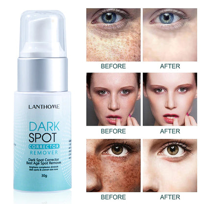 Dark Spot Corrector Remover 3