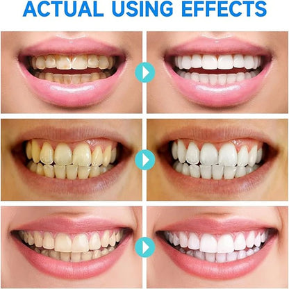 Niacinamide Whitening Toothpaste 3