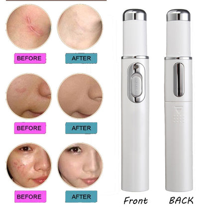 Light Therapy Acne Pen 3
