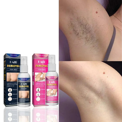 Body Hair Removal Spray 3
