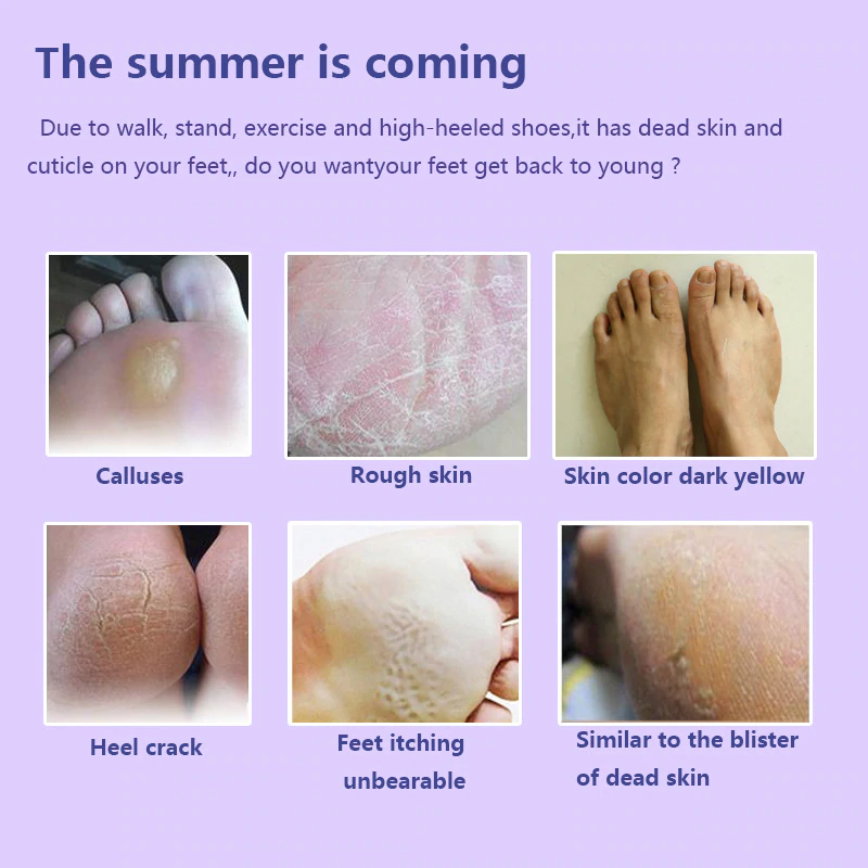 Deep Hydration Lavender Foot Peeling mask 3