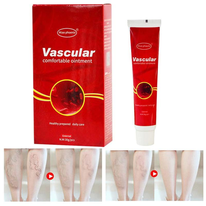 VARICOSE VEINS REMOVAL CREAM 1
