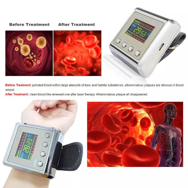 Hypertension Laser Therapy Watch 4