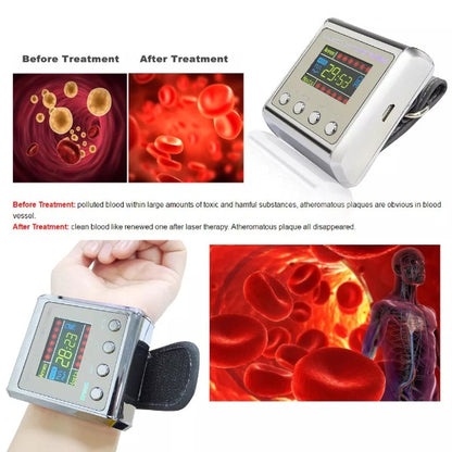 Hypertension Laser Therapy Watch 4