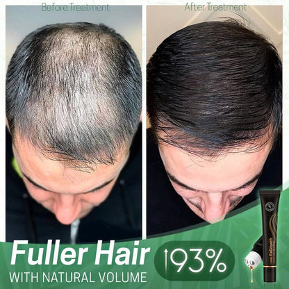 Organic Hair Serum Roller 4