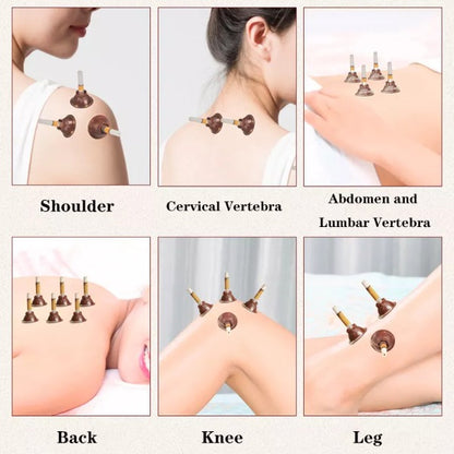 Acupoint Body Acupuncture 4