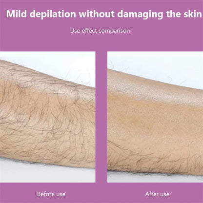 Painless Exfoliation Crystal Hair Removal Tool 4
