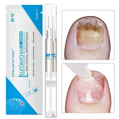 Eucony Fast Acting Toenail Cure – 3ml (PACK OF 4) 4