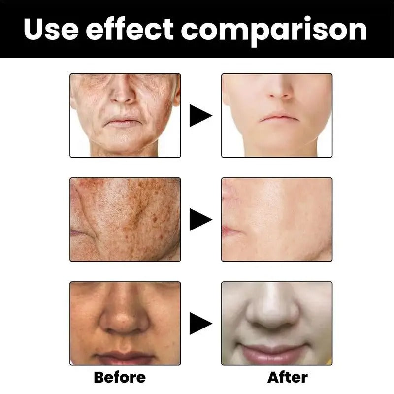 Skin Melanin Correcting Facial Serum 4