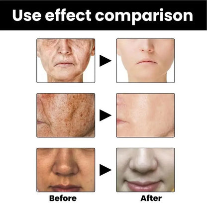Skin Melanin Correcting Facial Serum 4