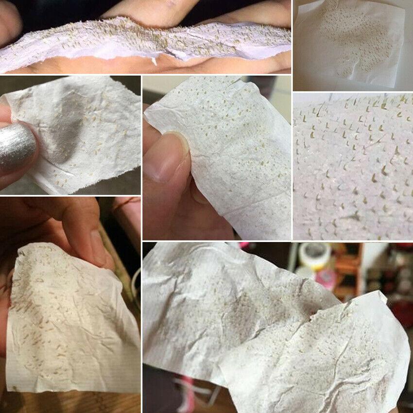 BLACKHEAD STRIP 4