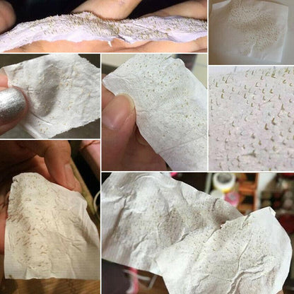 BLACKHEAD STRIP 4