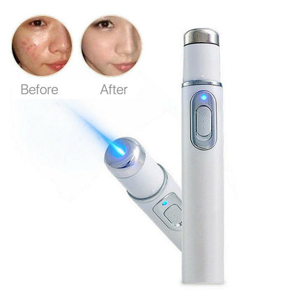 Skin Spots Removal Laze Pen 4