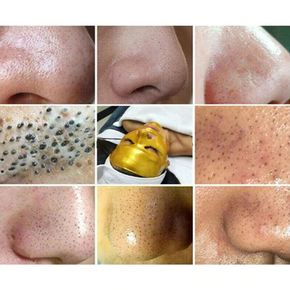 Gold Peel-Off Mask 4