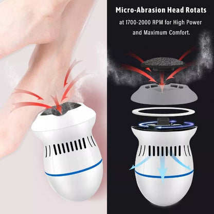 Foot File Pedicure Tools with Vacuum 4