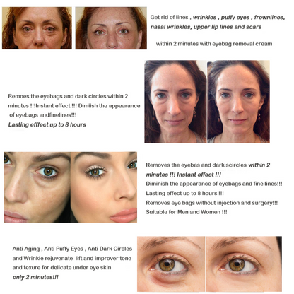 Magic Eye Cream 4