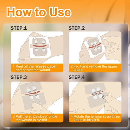 Wound Closure Device-4PCS 4