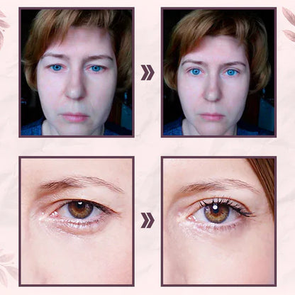 Palp Lifting Magic Eyelid Lifter (600PCs) 4
