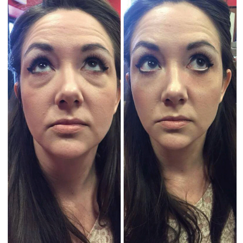 Eye Delight Boost Serum 4