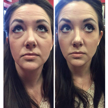 Eye Delight Boost Serum 4