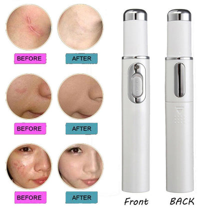 Light Therapy Acne Pen 4