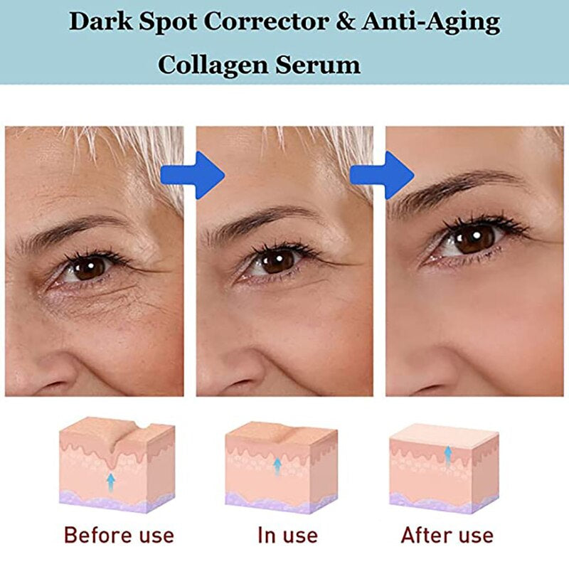 YouthRestore NMN Eye Cream 4