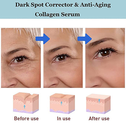 YouthRestore NMN Eye Cream 4