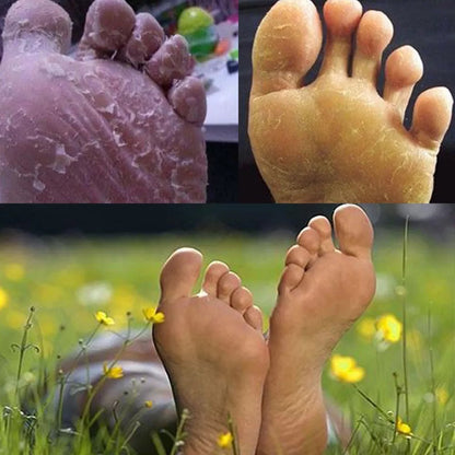Anti-fungal Exfoliating Foot Soak 4