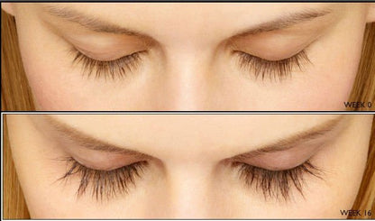 FEG Eyelash Enhancer 4