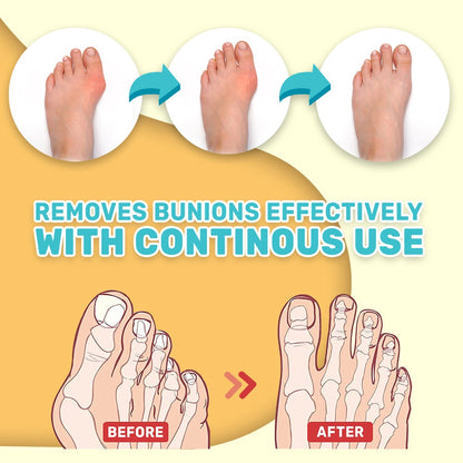 Bunion Toe Stiffness Relief Cream 4