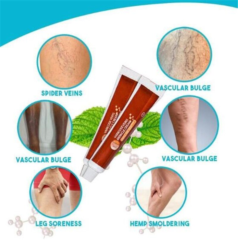 Varicose Veins Miracle Cream 4