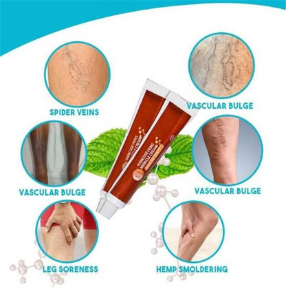 Varicose Veins Miracle Cream 4