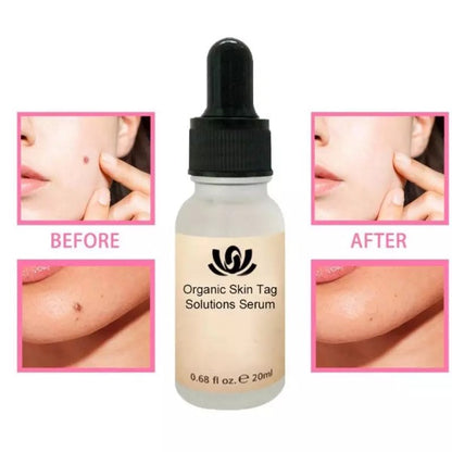 Organic Skin Spot Purifying Serum 4