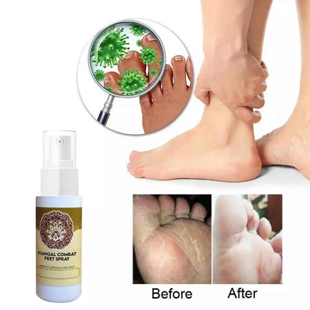 Anti-Fungal Treatment Spray 4
