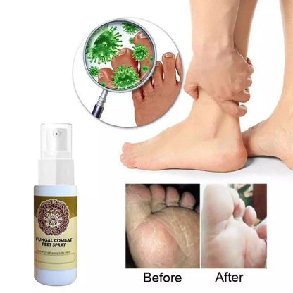 Anti-Fungal Treatment Spray 4