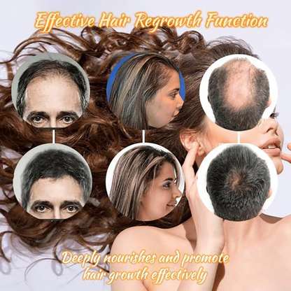 Hair Regrowth Essence Intensive Spray 4