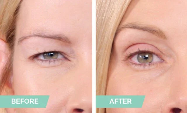 Natural Invisible Eyelid 4