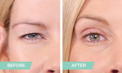 Natural Invisible Eyelid 4