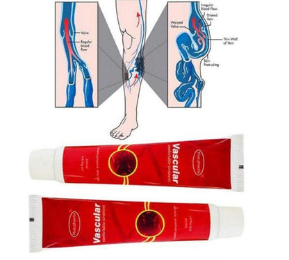 VARICOSE VEINS REMOVAL CREAM 4