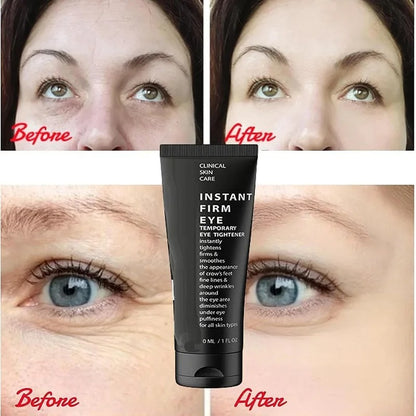Instant Eye Firming Cream 5