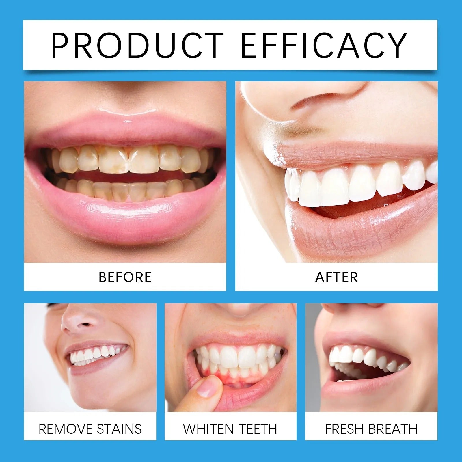 Teeth Whitening Powder | Whitening and Stain Removal 5