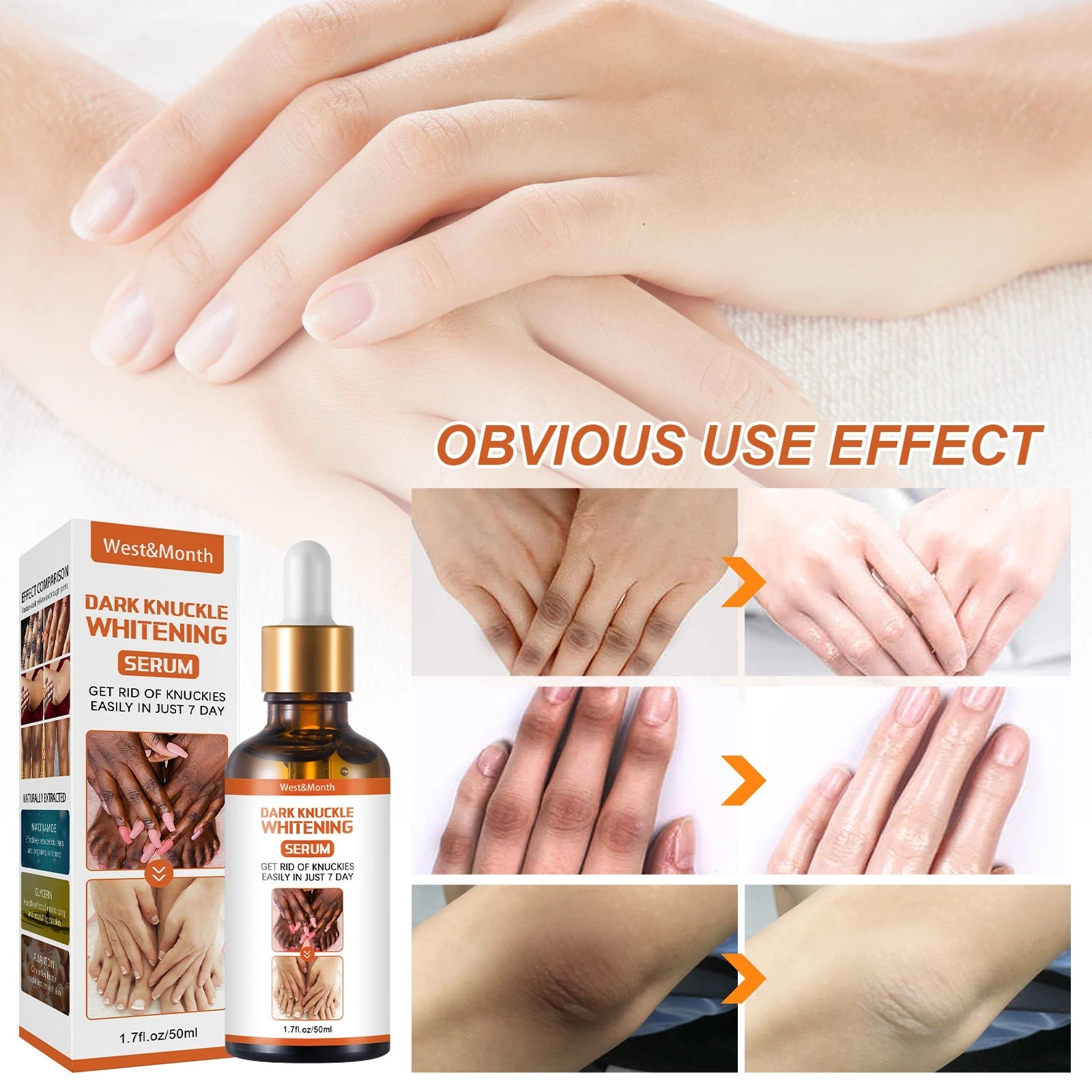 Acanthosis Nigricans Therapy Oil 5