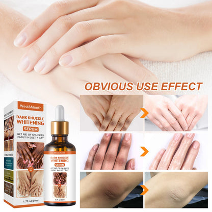 Acanthosis Nigricans Therapy Oil 5