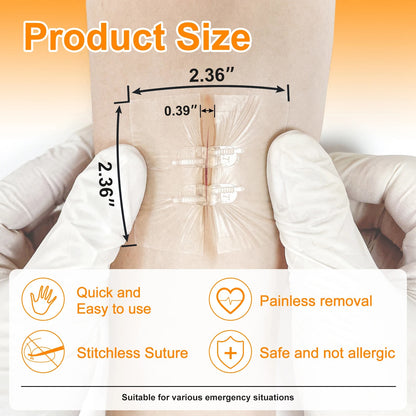 Wound Closure Device-4PCS 5